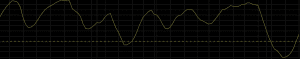 fisher transform